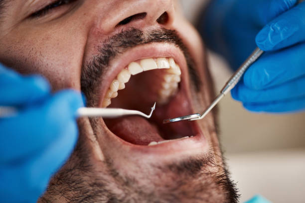 Best Pediatric Emergency Dentist in Plantsville, CT