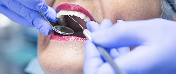 Best Emergency Dentist for Lost Fillings or Crowns in Plantsville, CT